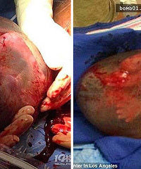 ��������һ����Ĥ�ұ��� �����ֶ����װ