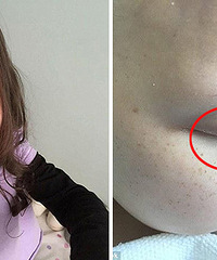 ���飡7��СŮ�����ƺ�ֻʣ1����ë