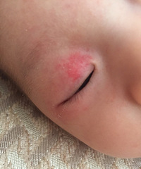 �����ơ�ҽ�� ��������������Ƥ���к�� ���ڻ�û