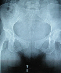 ����7�����³ܹǷ��� ҽ�������ʸ��� �������ţ���������