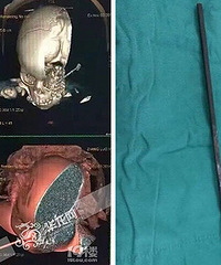 2����ͯˤ�����Ӳ����� ԭ����...