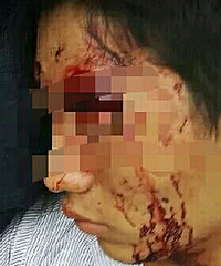 ��ݹ������ڽ� ���ֹܴ�ɻ���