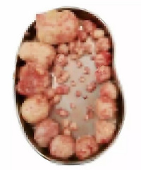 Ů��ͷ̥���������� ׼������̥������...