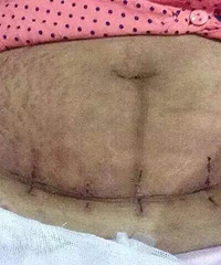 ��̥�ʸ��� ���Ѫ����ӹ����� û�뵽����...