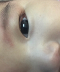 ��������Ƥ���а�ɫ��һ������