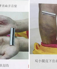 Ů�������ļ�ĸ �ö�������ʩ��Ű��...