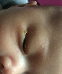 ����һֻ�۾���ʺ��