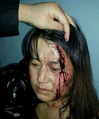 �������ҹ���ؼ� ��򾹰��Ҵ��ͷ��Ѫ������ҽԺ��