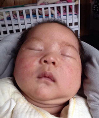 ��֧�ж���7����һֱ������ʪ�� ����һ��ץ������Ѫ����...