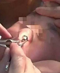 ������3��С�к��ǿ׳����ƶ�ѿ ԭ����...