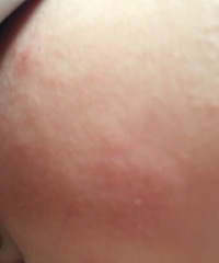 ��á�ҽ�����Ҽұ���8�����¹������ʡ���