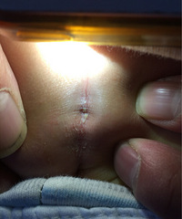 ƨ�ɺ�������