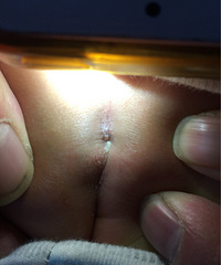 ƨ�ɺ�������