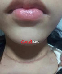 9��Ů�����������ְ�����������Ҫ��ҩ....