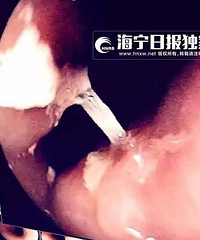 Ҫ������������һ�������ȵ�ƨ��ʹ������û�뵽��̿��������δ�