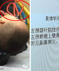 �ۣ�2����ͯ��ˣʱ �Ѽ�����������...