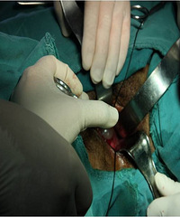 �������� ����ʹ����������������֢ �����˶�������...