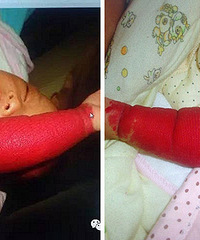 �ճ����ı��� һֻ�ֱ۾�Ȼ�Ǻ�ɫ�ģ�