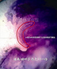 5����ͯ����ͻȻ������ ԭ���۵׳������׳�...