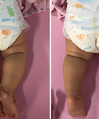 2���±������Ʋ��Գ� ����û�������