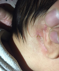 ��ҽ����æ��������ʲô