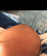 ��ҽ����ã����������£�ͷ�����ǳ���ɶ��