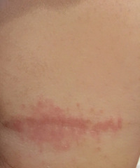 ����ƨ���Ա���һƬ��Ŀ���