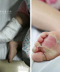 5��Ůͯ���ĸ���Ű�� 9���߹ǹ���