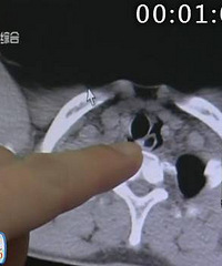 ������15��С��ÿ���ڼҿ����ڼ� �����������ĳ������ը�ˣ�