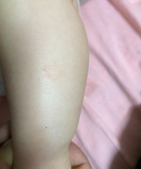 ��ҽ����ã�6�����±���С���ϳ��������