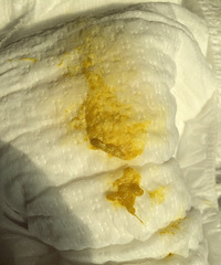 �����ӣ���ͼ���㣩