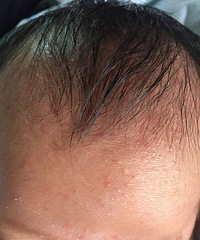 �����ơ�����ҽ����æ���±������ϳ�����ʲô