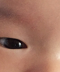 2������Ӥ���۾�������һ��Ĥ