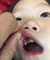 ����ҽ���Ҽұ��������ô���£������ϳ���