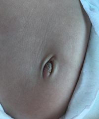 ��ҽ����һ���챦�����ڶ����۶�����������