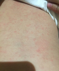 ��ҽ����ã�������11�����ˣ�ǰ�����һ