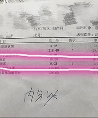 �ټ�״�ټ���ƫ��  ���������գ�