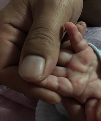 ��ҽ�������췢�ֱ���������������������