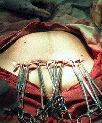 ��ʹ��4ָ��  ̥ͷ�²��� ��ˮ���� �����ʸ��� û�뵽..