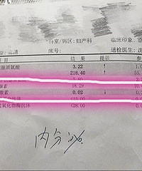 �ټ�״�ټ���ƫ�� ҽ��˵����������