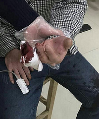 �ɷ��޳��� ��������ŭ���Լ�һ����ָ