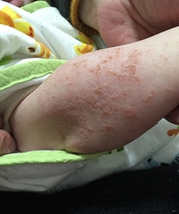 �����ֱ�ʪ�������