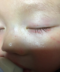 �����۾�������ʲô��