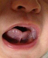 ������ϵ���쳤��ʯͷ���� ��������׼ ������ֱ�Ӽ���