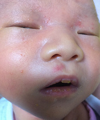 ��Ѫ������