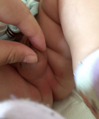 ��ҽ�����Ҽұ���55�죬С������Χ����