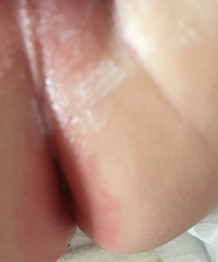 ��ҽ�����Ҽұ���55�죬С������Χ����