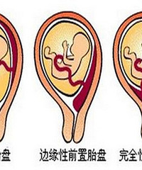 ����B������ʾ̥�̺�ڵĶ��������ӵ� ǰ�ڵĶ�����Ů�� ׼��