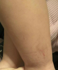 @��ҽ�� ������������ץ��Ѫ��