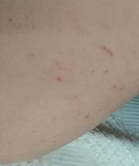 @��ҽ�� ������������ץ��Ѫ��